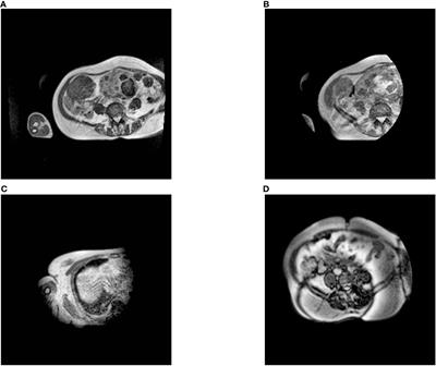 Deep learning application for abdominal organs segmentation on 0.35 T MR-Linac images